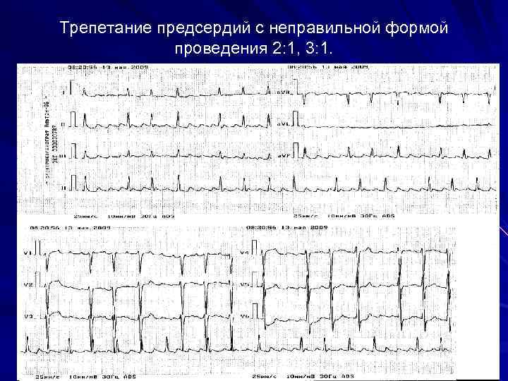 Проведение 2 1