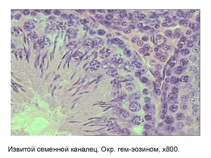 Извитой семенной каналец. Окр. гем-эозином, х800. 