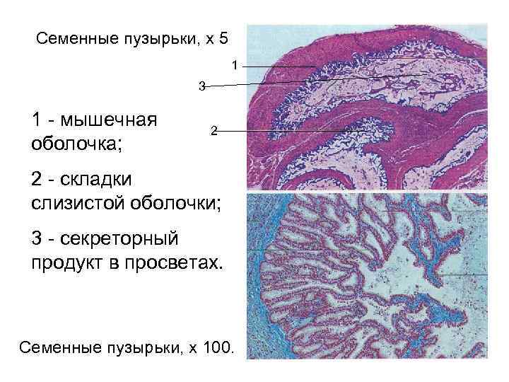 5 семенной пузырек