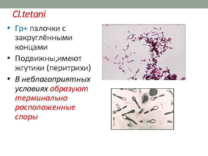 Cl. tetani • Гр+ палочки с закруглёнными концами • Подвижны, имеют жгутики (перитрихи) •