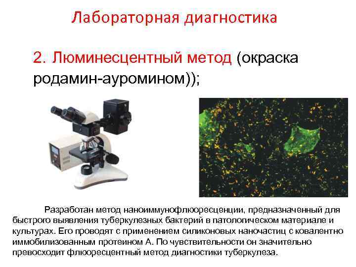 Лабораторная диагностика 2. Люминесцентный метод (окраска родамин-ауромином)); Разработан метод наноиммунофлюоресценции, предназначенный для быстрого выявления