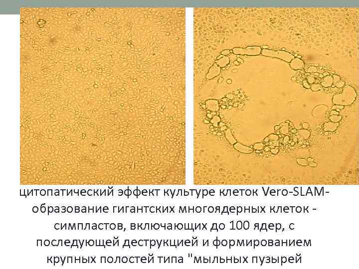 цитопатический эффект культуре клеток Vero-SLAM- образование гигантских многоядерных клеток - симпластов, включающих до 100