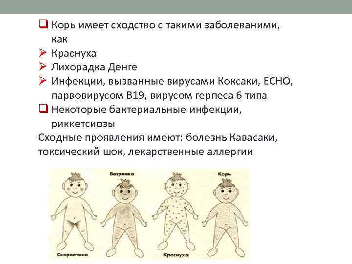 q Корь имеет сходство с такими заболеваними, как Ø Краснуха Ø Лихорадка Денге Ø