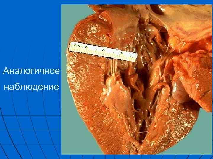 Аналогичное наблюдение 