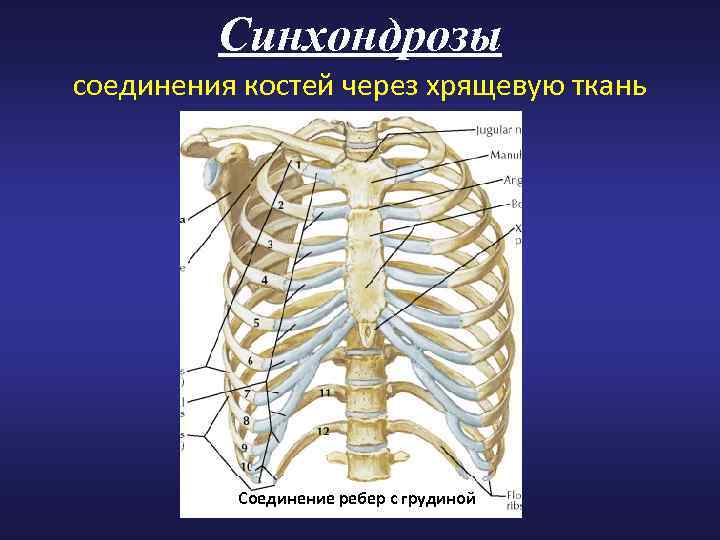 Первые соединяют вторые. Грудинореберный синдоходроз 2 ребра. Грудино реберный синхондроз 1 ребра. Синхондроз рукоятки грудины. Грудинореберный синдоходроз 1 ребра.