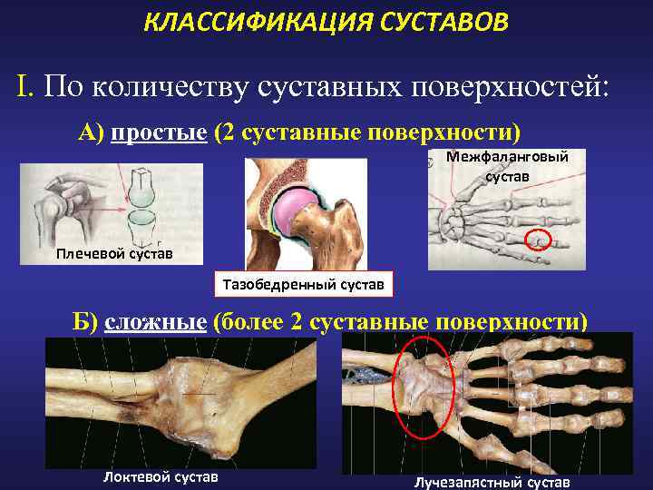 КЛАССИФИКАЦИЯ СУСТАВОВ I. По количеству суставных поверхностей: А) простые (2 суставные поверхности) Межфаланговый сустав