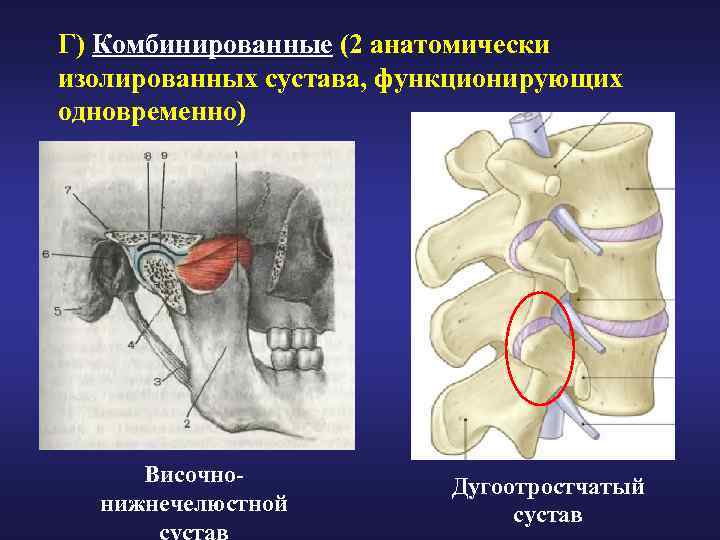 Г) Комбинированные (2 анатомически изолированных сустава, функционирующих одновременно) Височнонижнечелюстной Дугоотростчатый сустав 