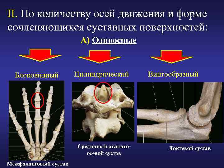 II. По количеству осей движения и форме сочленяющихся суставных поверхностей: А) Одноосные Блоковидный Цилиндрический