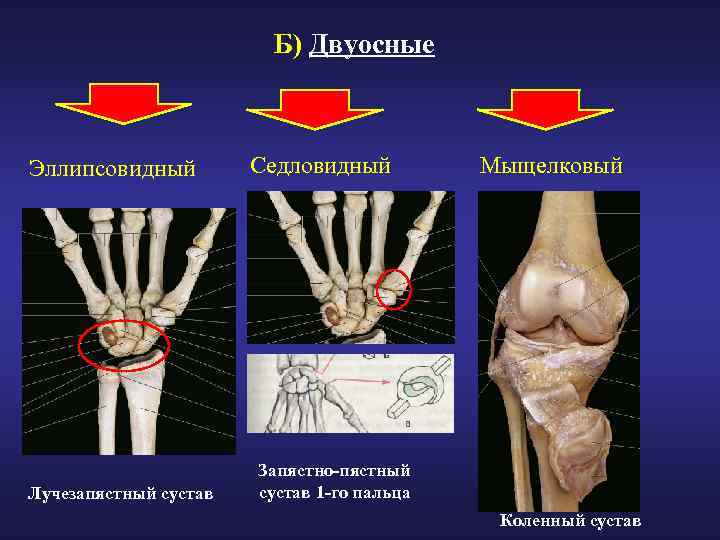 Б) Двуосные Эллипсовидный Лучезапястный сустав Седловидный Мыщелковый Запястно-пястный сустав 1 -го пальца Коленный сустав