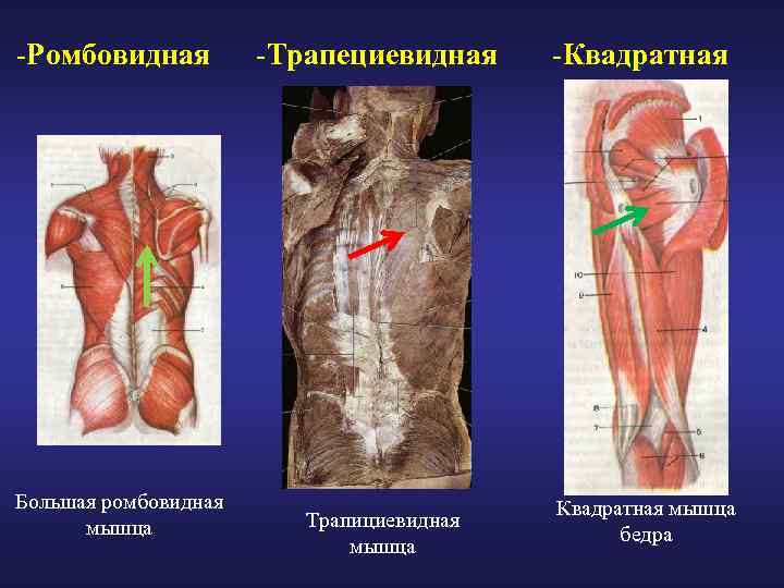 -Ромбовидная Большая ромбовидная мышца -Трапециевидная Трапициевидная мышца -Квадратная мышца бедра 