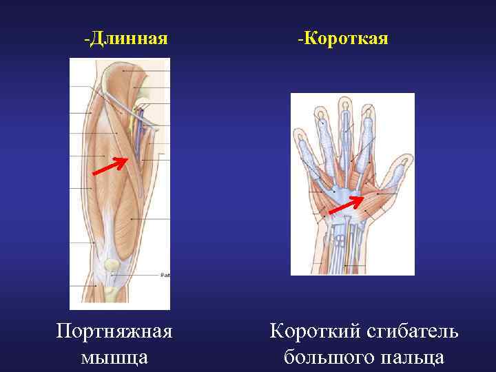 -Длинная Портняжная мышца -Короткая Короткий сгибатель большого пальца 