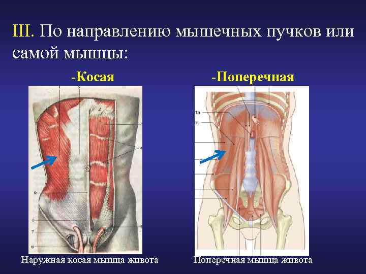 Направления мышц. Мышцы по направлению мышечных Пучков. Поперечная мышца живота анатомия. Сшивание косых мышц живота. Как направлены волокна наружной косой мышцы живота?.