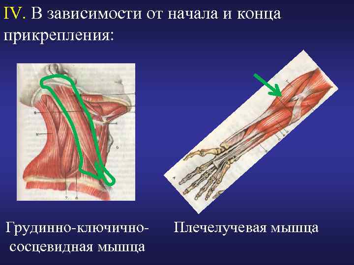 IV. В зависимости от начала и конца прикрепления: Грудинно-ключичнососцевидная мышца Плечелучевая мышца 