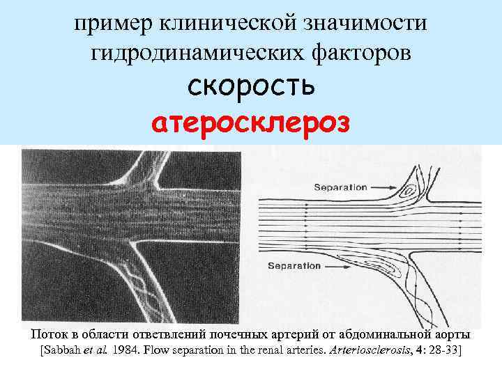 пример клинической значимости гидродинамических факторов скорость атеросклероз Поток в области ответвлений почечных артерий от