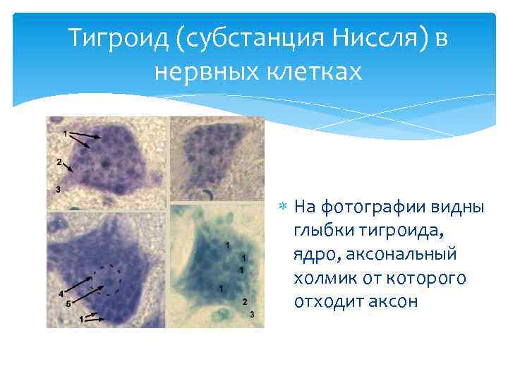 Тигроид (субстанция Ниссля) в нервных клетках На фотографии видны глыбки тигроида, ядро, аксональный холмик