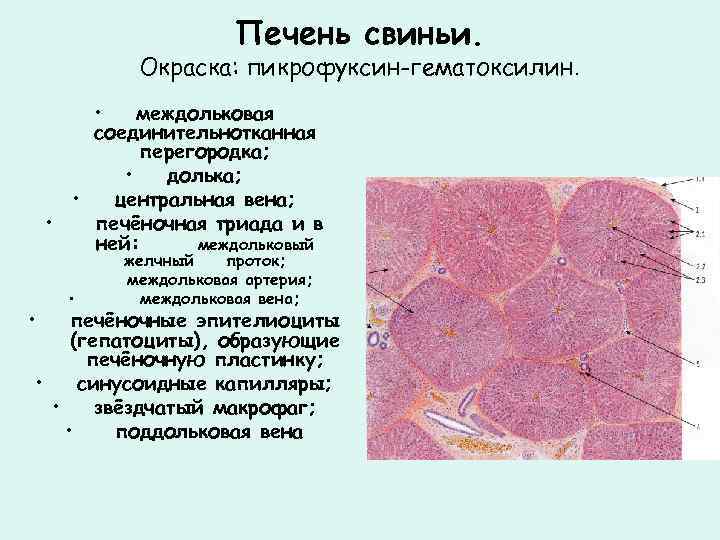 Печень свиньи. Окраска: пикрофуксин-гематоксилин. • междольковая соединительнотканная перегородка; • долька; • центральная вена; •