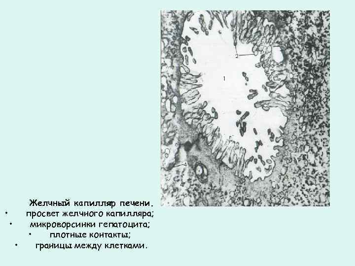 Желчный капилляр печени. • просвет желчного капилляра; • микроворсинки гепатоцита; • плотные контакты; •