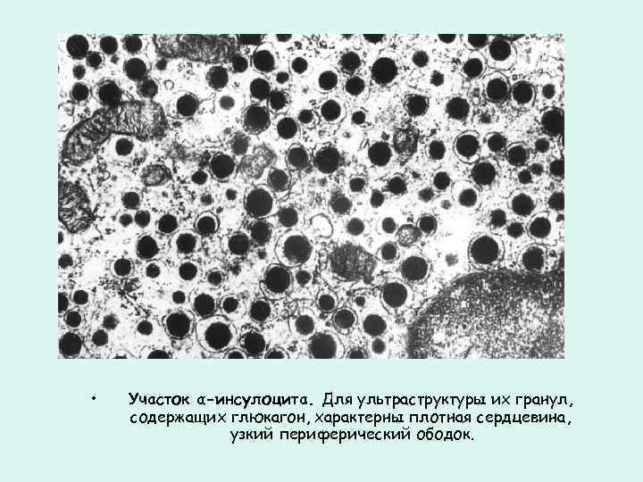  • Участок α-инсулоцита. Для ультраструктуры их гранул, содержащих глюкагон, характерны плотная сердцевина, узкий