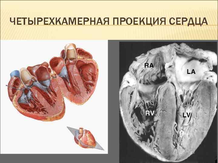 Четырёхкамерное сердце. Представители четырехкамерного сердца. Кт анатомия сердца. Четырехкамерный срез сердца