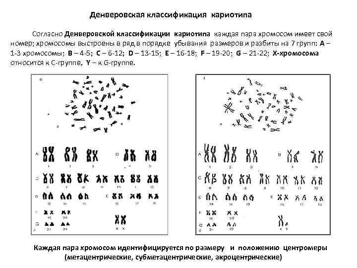 Денверовская классификация кариотипа Согласно Денверовской классификации кариотипа каждая пара хромосом имеет свой номер; хромосомы