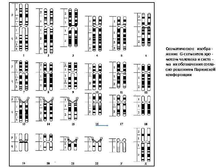 Схематическое изобра жение G-сегментов хро мосом человека и систе - ма их обозначения согла-