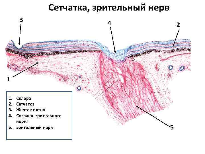 Сетчатка, зрительный нерв 3 4 2 1 1. 2. 3. 4. Склера Сетчатка Желтое