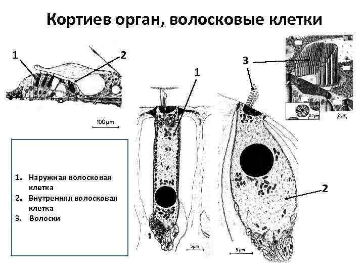 Волоски волосковых клеток