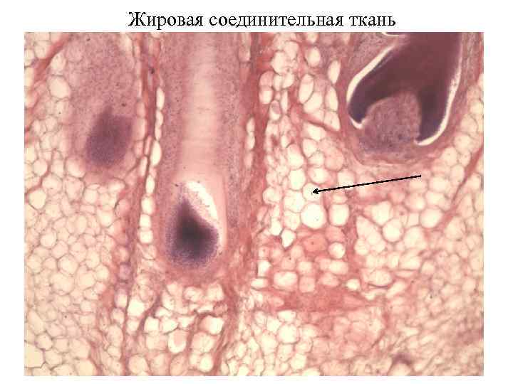 Жировая соединительная ткань 