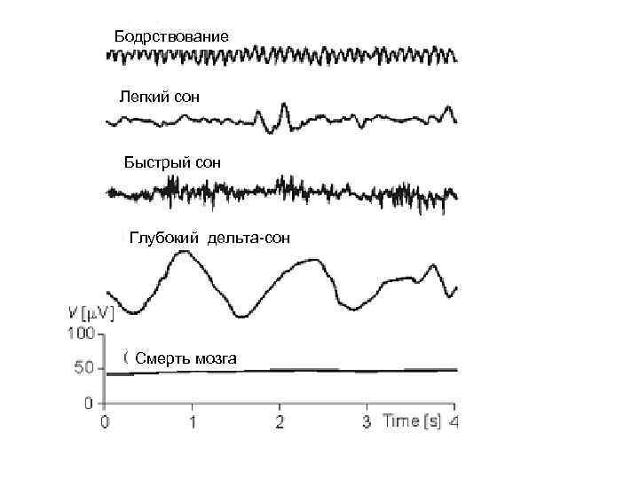 Бодрствование Легкий сон Быстрый сон Глубокий дельта-сон Смерть мозга 