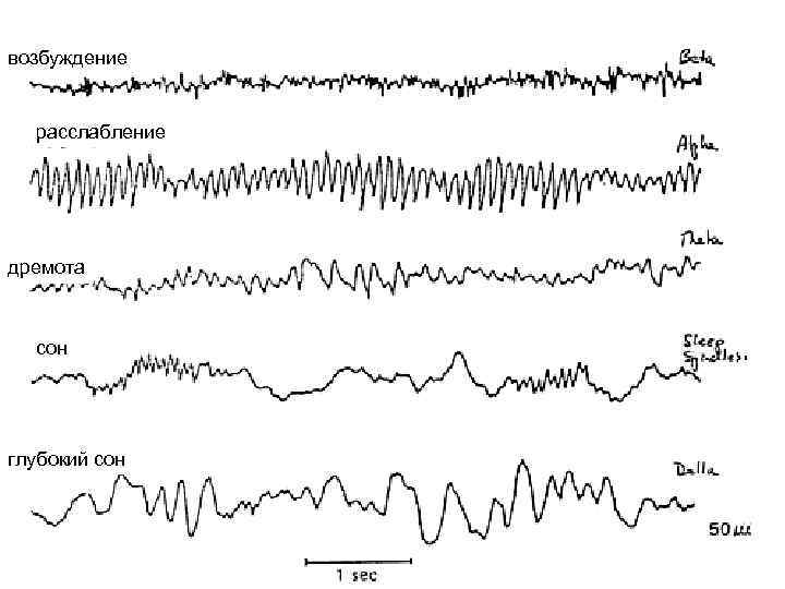 возбуждение расслабление дремота сон глубокий сон 