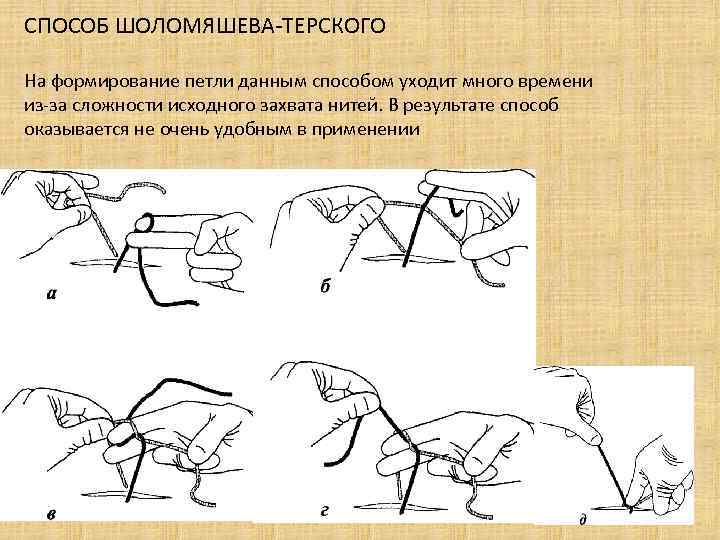 СПОСОБ ШОЛОМЯШЕВА-ТЕРСКОГО На формирование петли данным способом уходит много времени из-за сложности исходного захвата