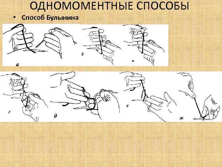 ОДНОМОМЕНТНЫЕ СПОСОБЫ • Способ Булынина 
