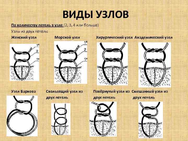 Хирургический узел схема