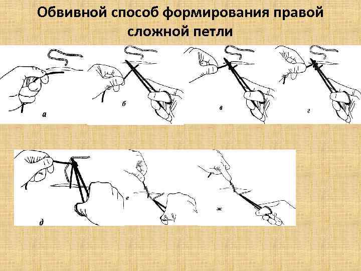 Обвивной способ формирования правой сложной петли 
