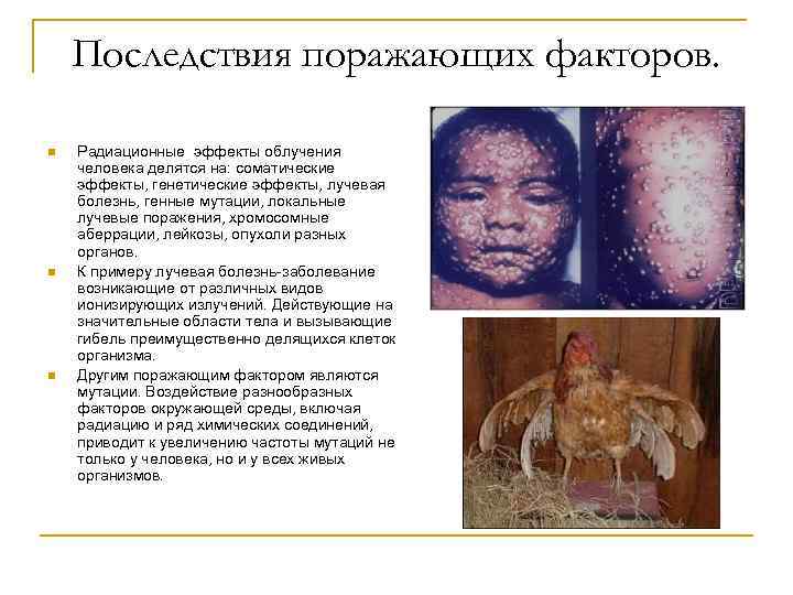 Последствия поражающих факторов. n n n Радиационные эффекты облучения человека делятся на: соматические эффекты,