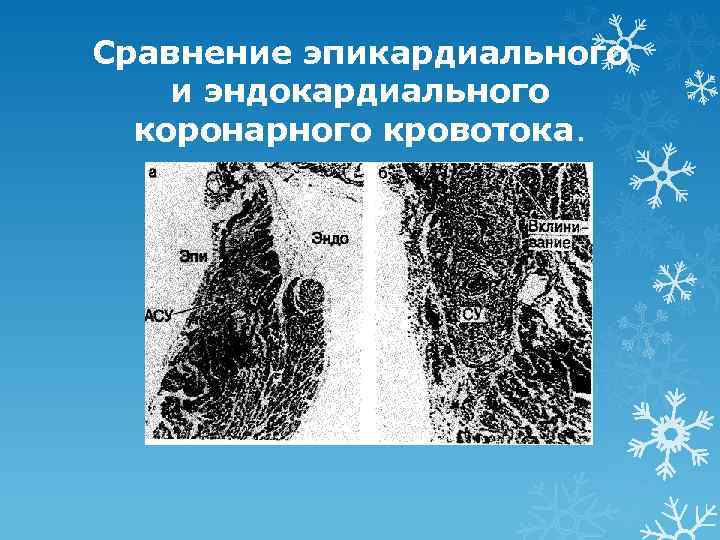 Сравнение эпикардиального и эндокардиального коронарного кровотока. 