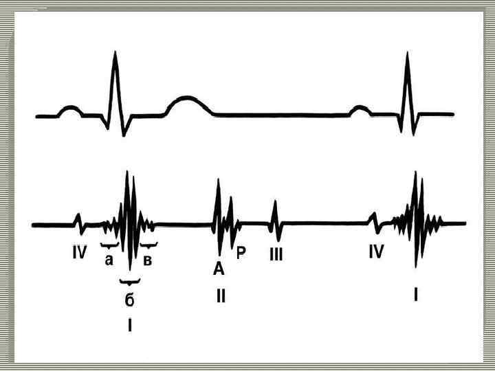 Тону сердца приглушенные. ФКГ 1тон 1 и 2 тона сердца. Тоны сердца фонокардиография. Тоны сердца на ЭКГ. Тоны сердца и их происхождение фонокардиография.