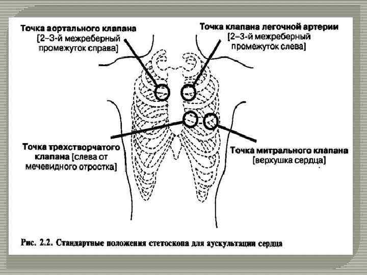  Точки аускультации сердца (I-V). I — область верхушечного толчка сердца (для выслушивания митрального