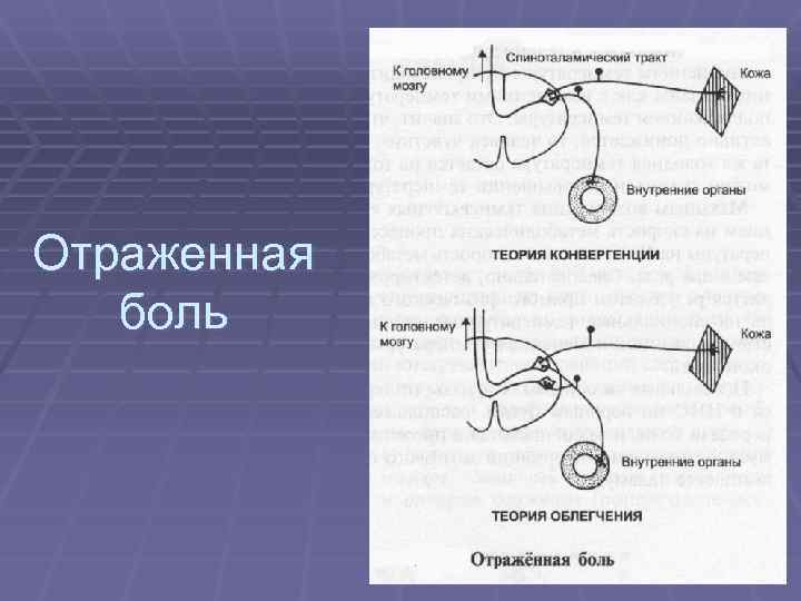 Основные механизмы боли схема