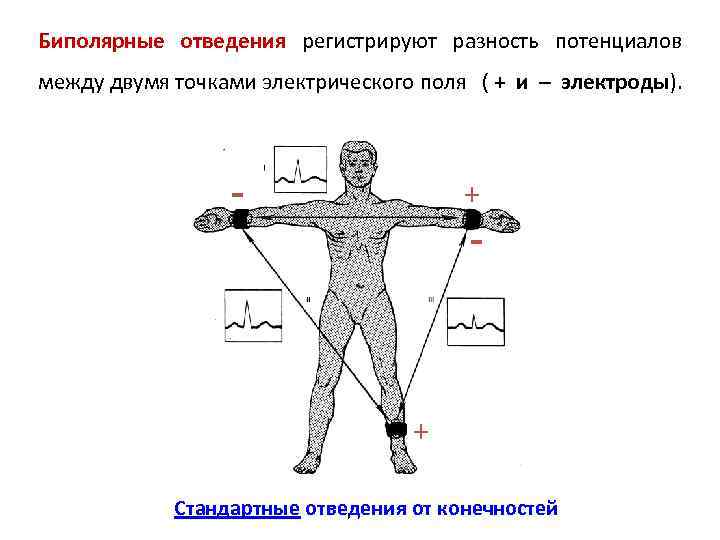 Отведения регистрирующее разность потенциалов