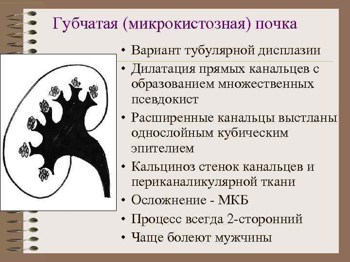 Губчатая (микрокистозная) почка • Вариант тубулярной дисплазии • Дилатация прямых канальцев с образованием множественных