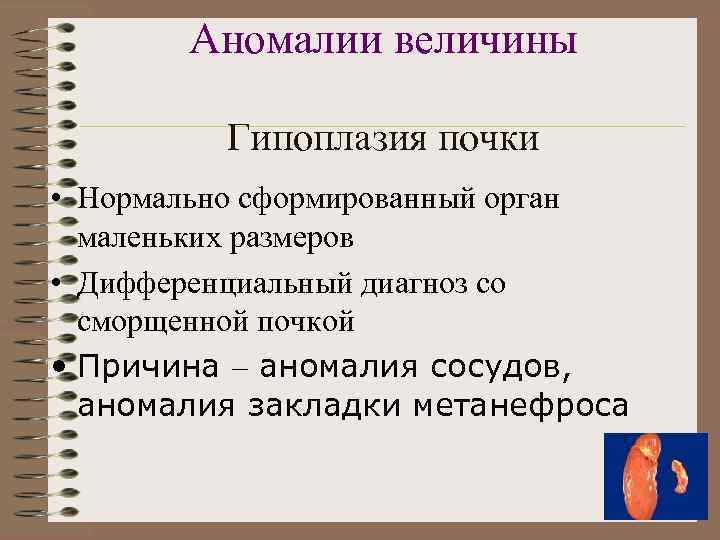 Аномалии величины Гипоплазия почки • Нормально сформированный орган маленьких размеров • Дифференциальный диагноз со