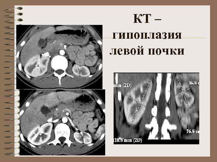 Формирование кт изображений основано на