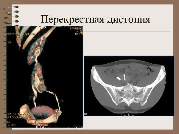 Перекрестная дистопия 