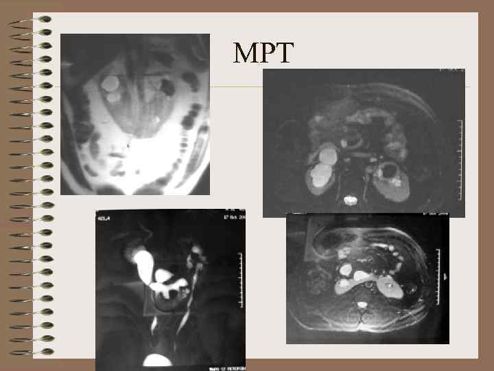 МРТ 