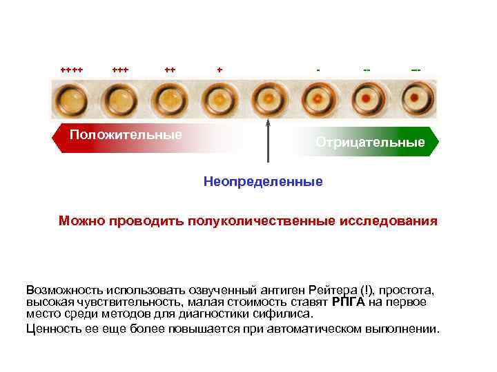 ++++ ++ Положительные + - -- --- Отрицательные Неопределенные Можно проводить полуколичественные исследования Возможность