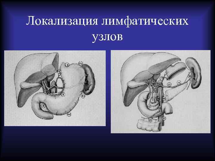 Локализация лимфатических узлов 