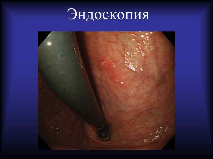 Эндоскопия 