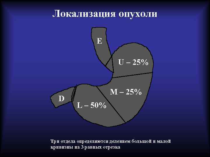 Локализация опухоли E U – 25% D M – 25% L – 50% Три