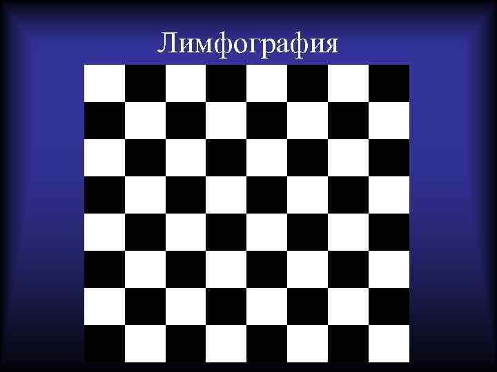 Лимфография 